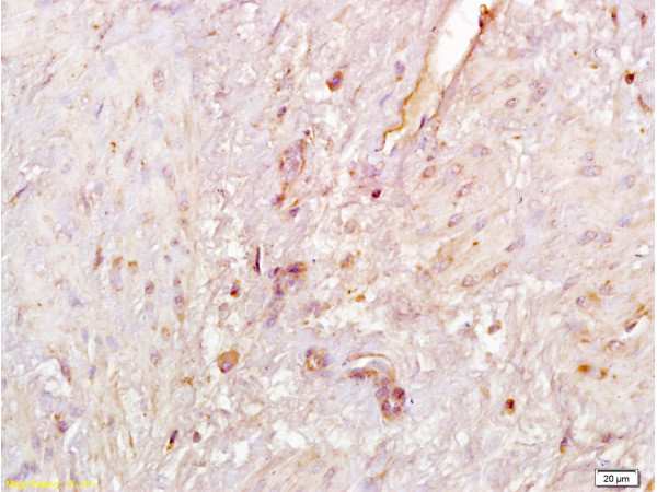 SIRT1 Antibody in Immunohistochemistry (Paraffin) (IHC (P))