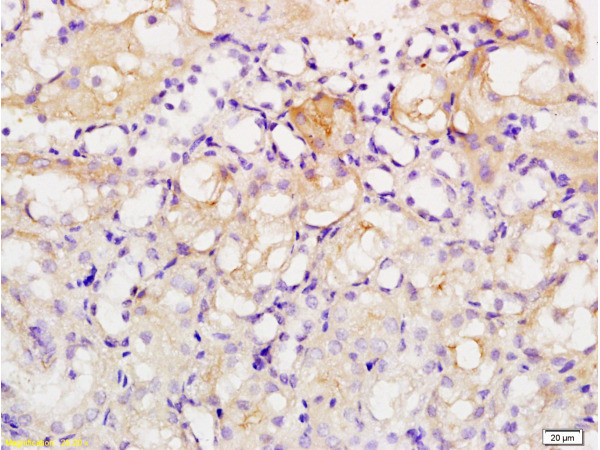 Acetyl-Histone H1 (Lys52) Antibody in Immunohistochemistry (Paraffin) (IHC (P))