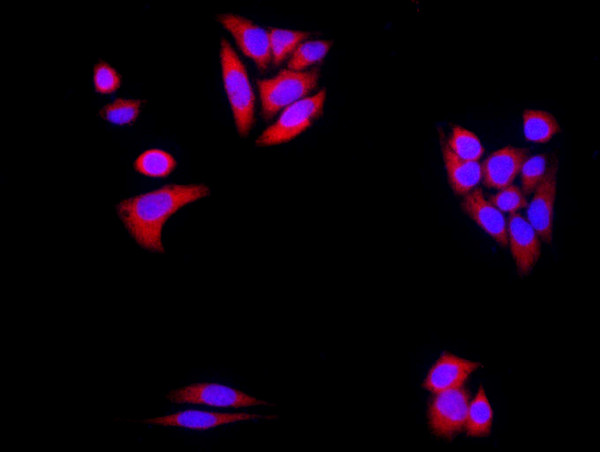 Alpha-Synuclein Antibody in Immunocytochemistry (ICC/IF)