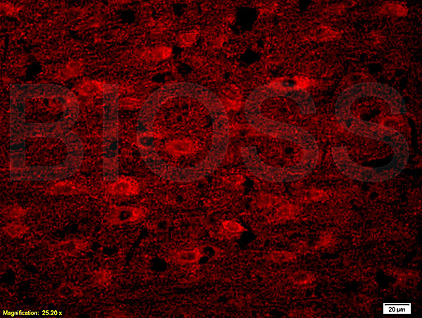 Alpha-Synuclein Antibody in Immunohistochemistry (Paraffin) (IHC (P))