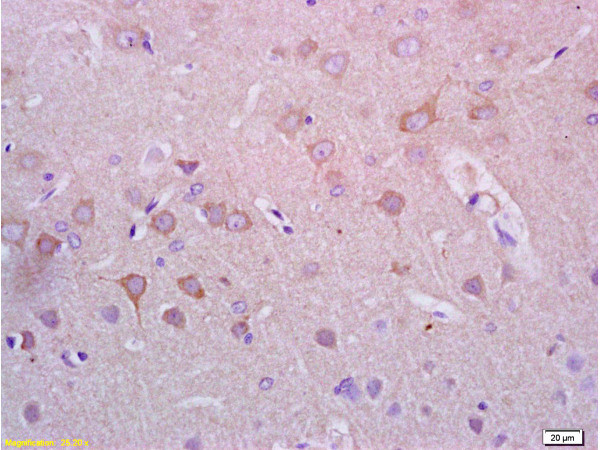 Alpha-Synuclein Antibody in Immunohistochemistry (Paraffin) (IHC (P))