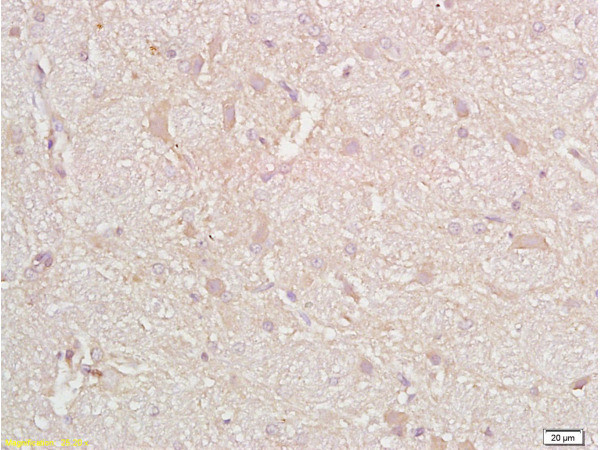 CD38 Antibody in Immunohistochemistry (Paraffin) (IHC (P))