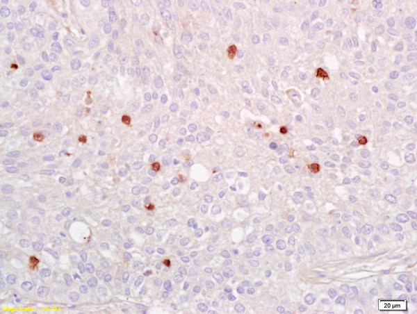 Phospho-NFKB p65 (Ser536) Antibody in Immunohistochemistry (Paraffin) (IHC (P))