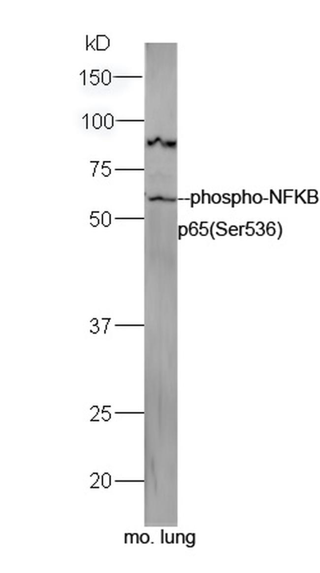 Phospho-NFKB p65 (Ser536) Antibody in Western Blot (WB)