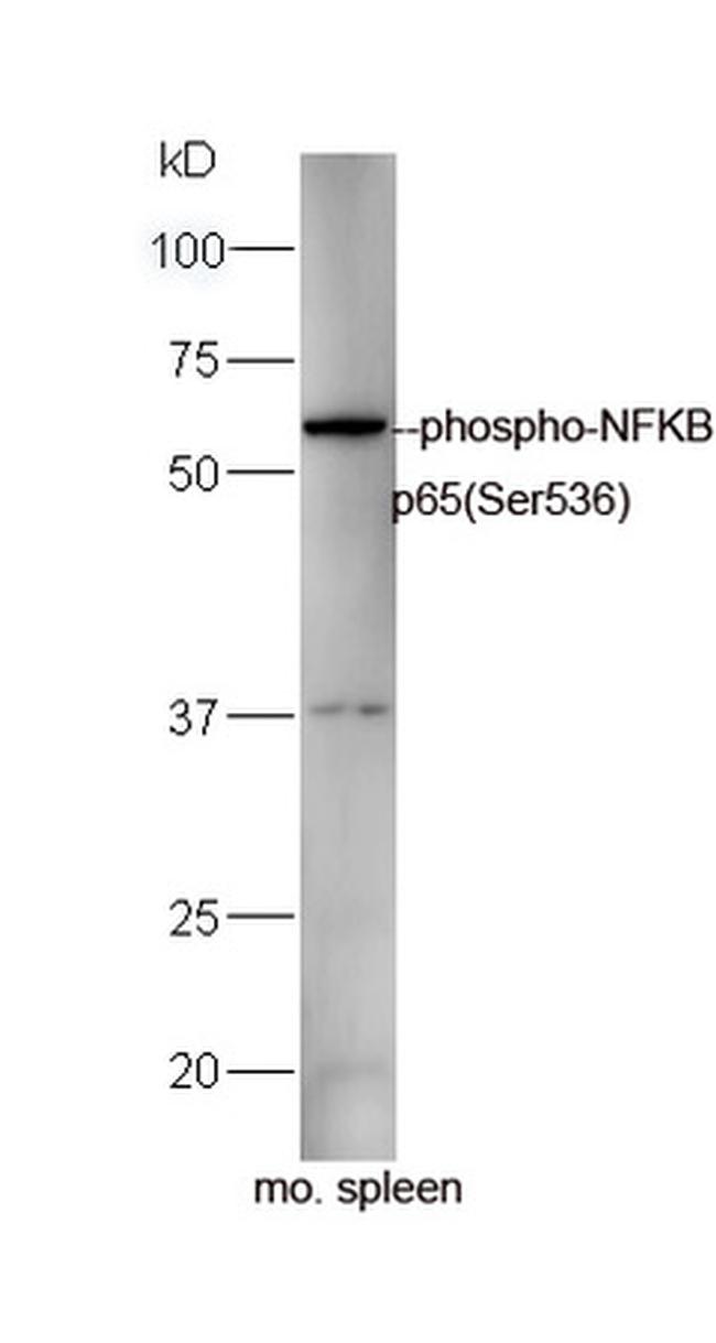 Phospho-NFKB p65 (Ser536) Antibody in Western Blot (WB)