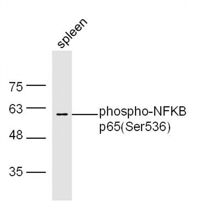 Phospho-NFKB p65 (Ser536) Antibody in Western Blot (WB)