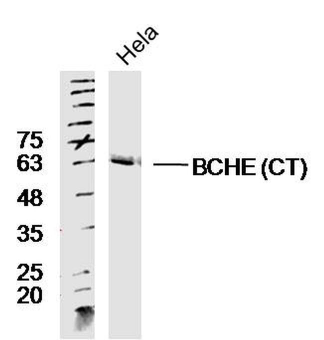 BCHE CT Antibody in Western Blot (WB)