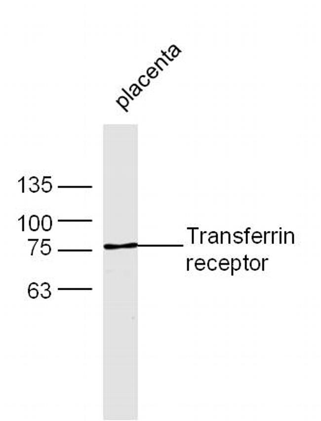 Transferrin receptor Antibody in Western Blot (WB)