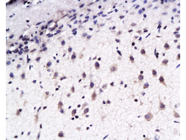 EphB2 Antibody in Immunohistochemistry (Paraffin) (IHC (P))