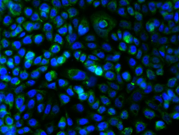 c-Kit Antibody in Immunocytochemistry (ICC/IF)