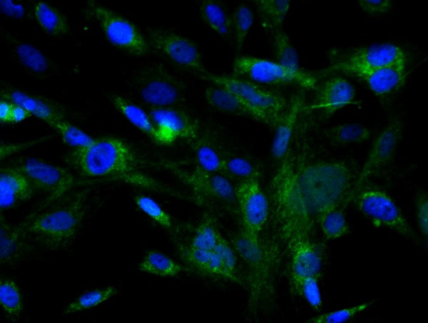 c-Kit Antibody in Immunocytochemistry (ICC/IF)