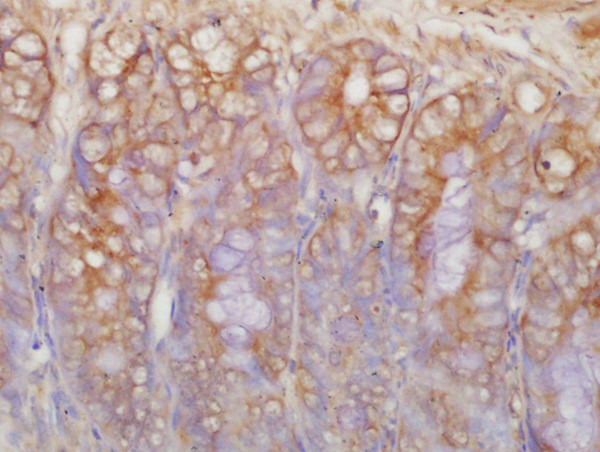 c-Kit Antibody in Immunohistochemistry (Paraffin) (IHC (P))