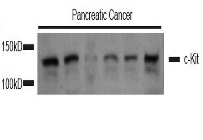 c-Kit Antibody in Western Blot (WB)