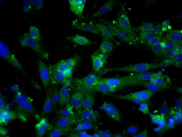 E cadherin Antibody in Immunocytochemistry (ICC/IF)