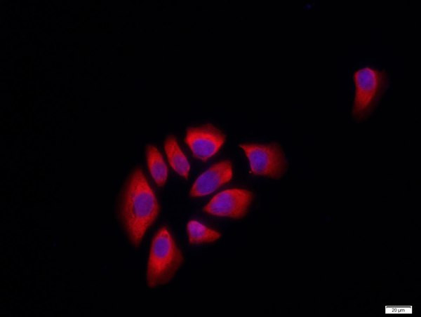 E cadherin Antibody in Immunocytochemistry (ICC/IF)