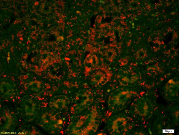 E cadherin Antibody in Immunohistochemistry (Paraffin) (IHC (P))