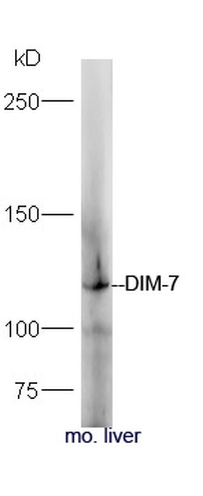 DIM-7 Antibody in Western Blot (WB)