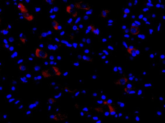 CIAS1 Antibody in Immunohistochemistry (Paraffin) (IHC (P))