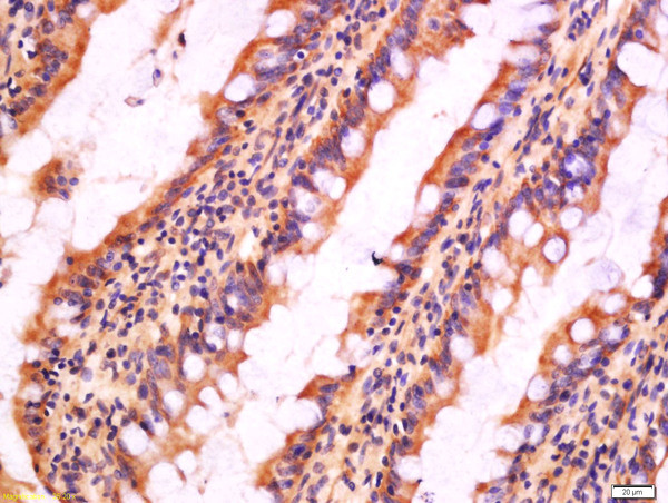 CIAS1 Antibody in Immunohistochemistry (Paraffin) (IHC (P))