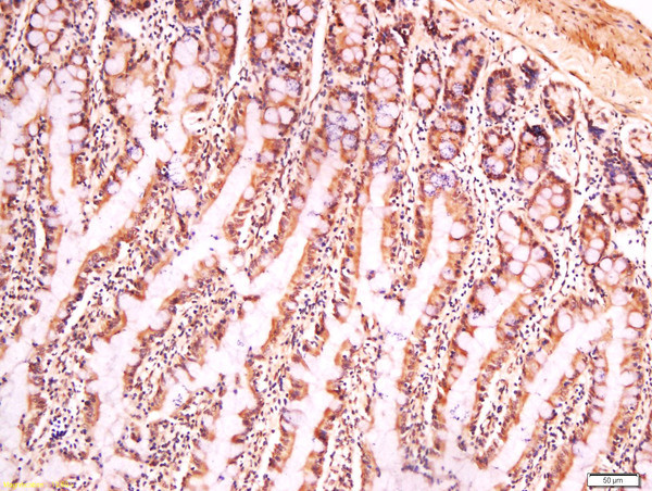 CIAS1 Antibody in Immunohistochemistry (Paraffin) (IHC (P))