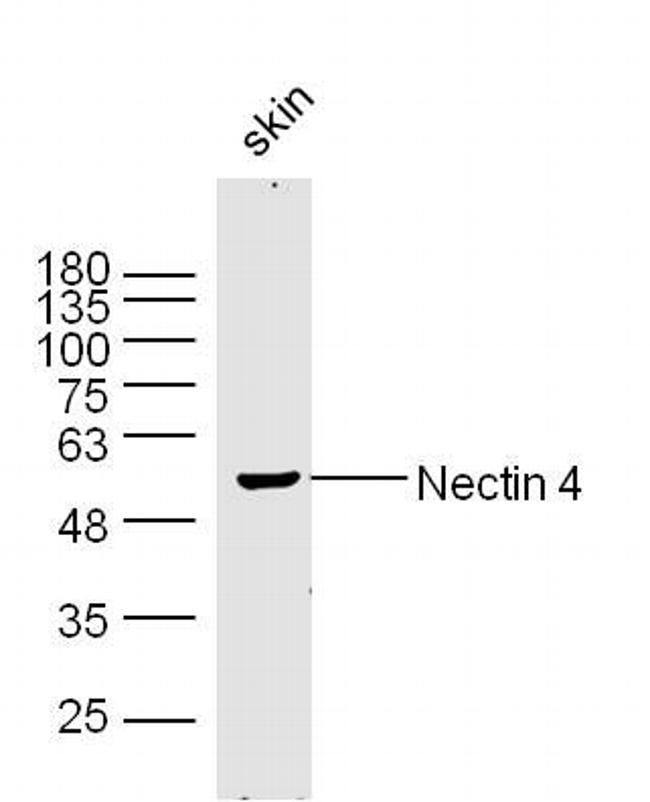 Nectin 4 Antibody in Western Blot (WB)