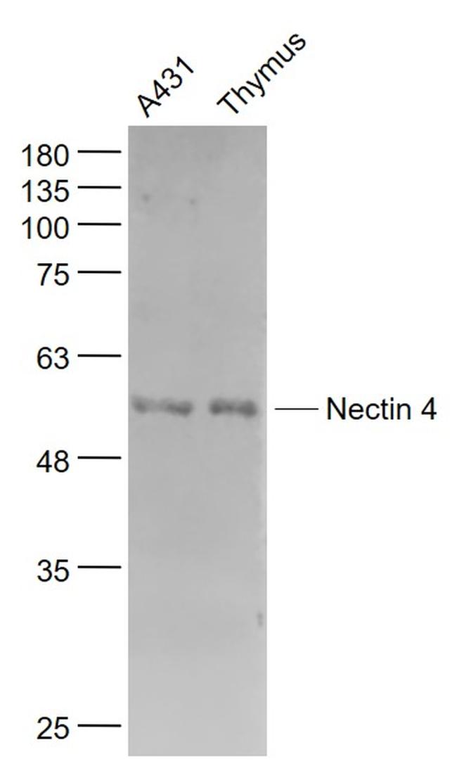 Nectin 4 Antibody in Western Blot (WB)