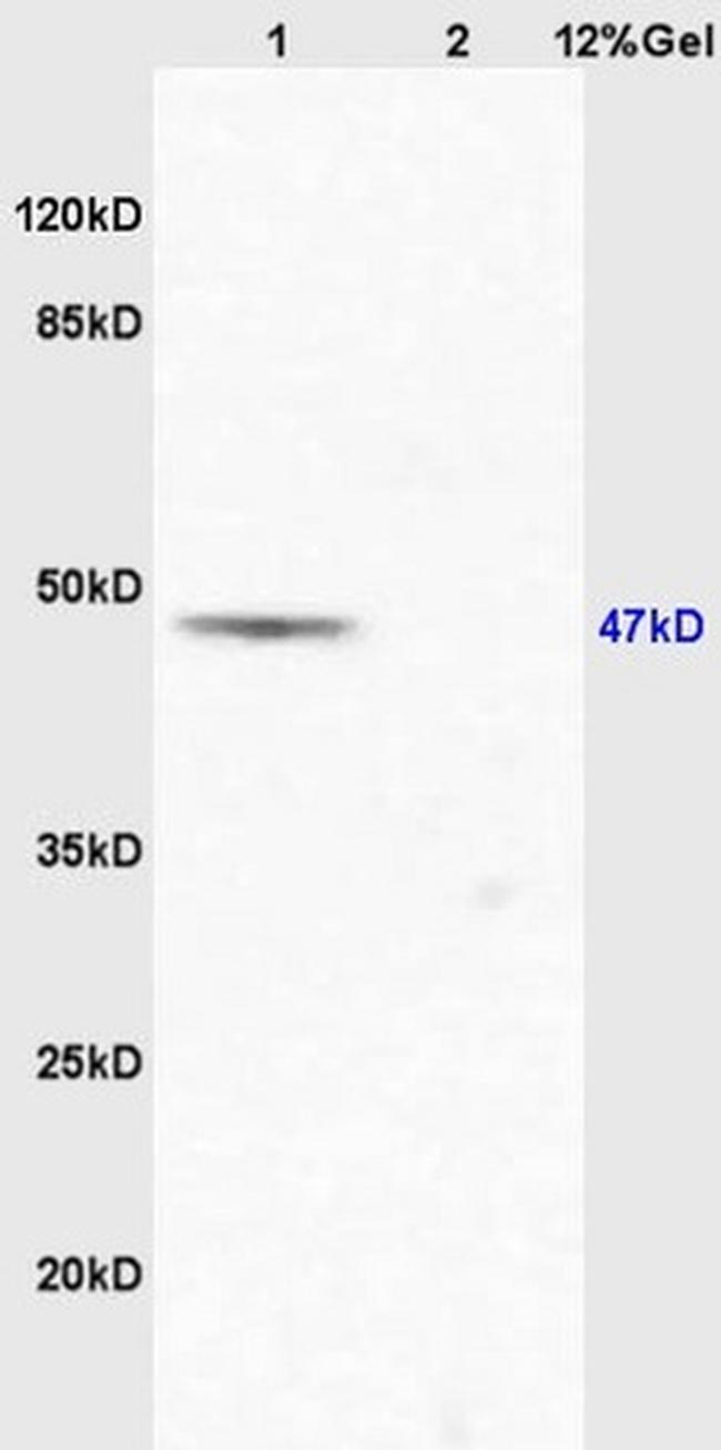 EIF5 Antibody in Western Blot (WB)