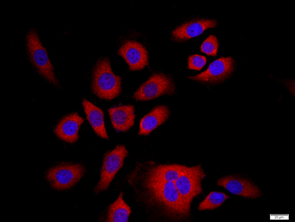 NFKB p100/p52 Antibody in Immunocytochemistry (ICC/IF)