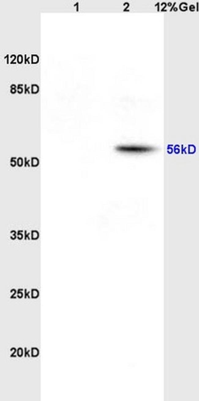 EAAT1 Antibody in Western Blot (WB)