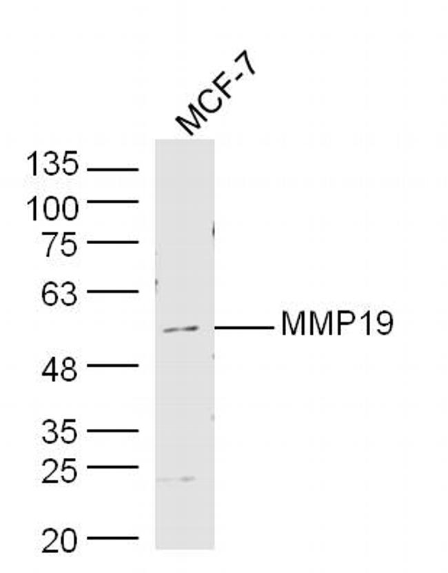 MMP19 Antibody in Western Blot (WB)