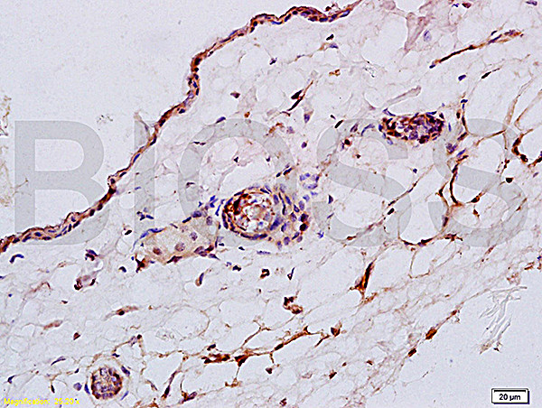 CK4 Antibody in Immunohistochemistry (Paraffin) (IHC (P))