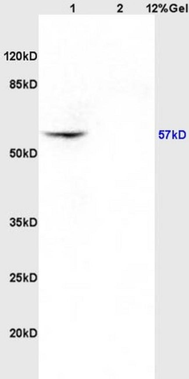 CK4 Antibody in Western Blot (WB)