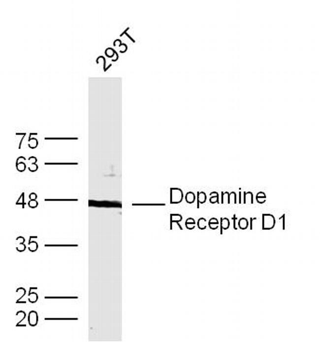 DRD1 Antibody in Western Blot (WB)