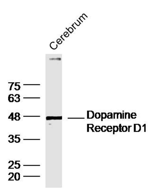 DRD1 Antibody in Western Blot (WB)