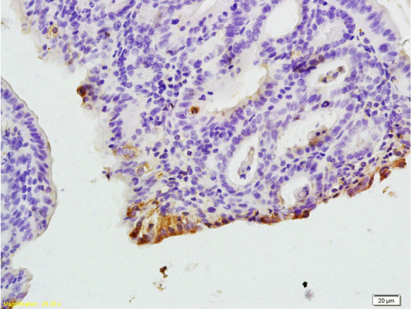 CXCR1 Antibody in Immunohistochemistry (Paraffin) (IHC (P))