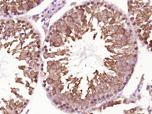 HSP90 alpha Antibody in Immunohistochemistry (Paraffin) (IHC (P))