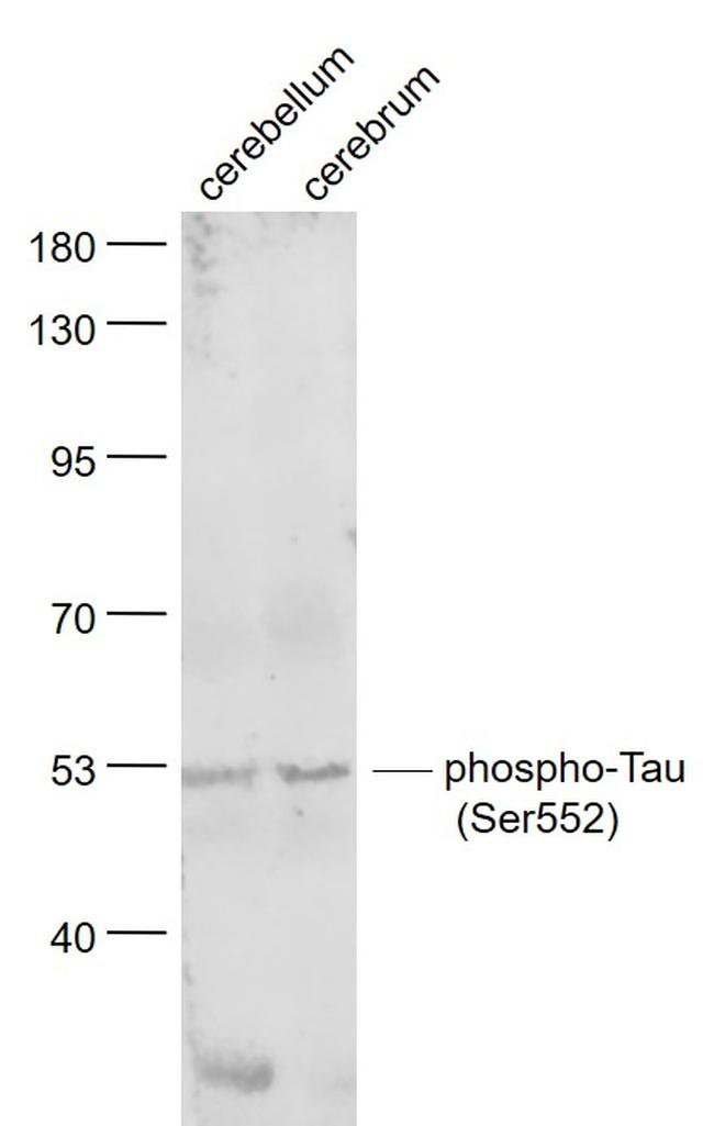 Phospho-Tau protein (Ser552) Antibody in Western Blot (WB)