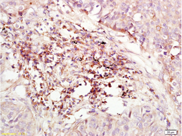 CXCR4 Antibody in Immunohistochemistry (Paraffin) (IHC (P))