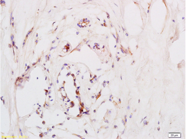 CXCR4 Antibody in Immunohistochemistry (Paraffin) (IHC (P))