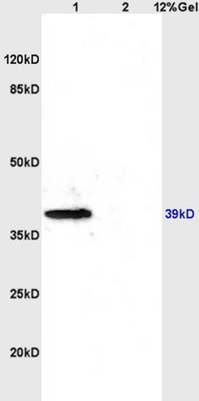 CXCR4 Antibody in Western Blot (WB)