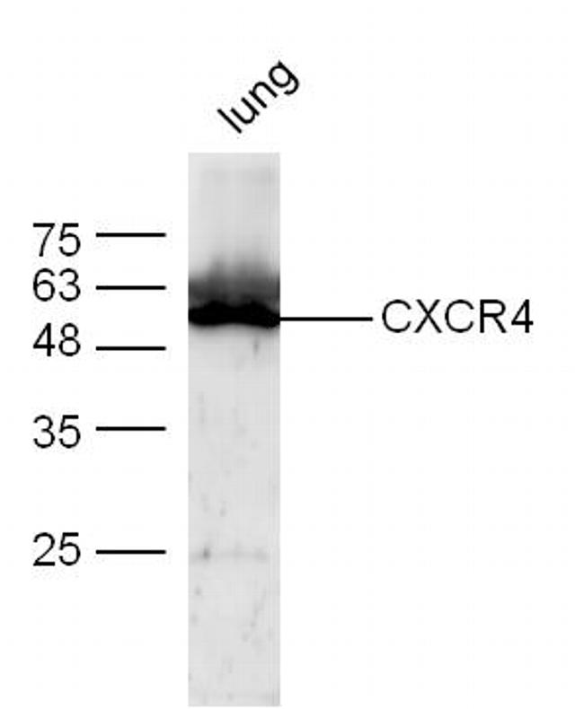 CXCR4 Antibody in Western Blot (WB)