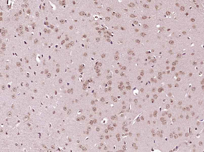 IKK alpha/beta Antibody in Immunohistochemistry (Paraffin) (IHC (P))