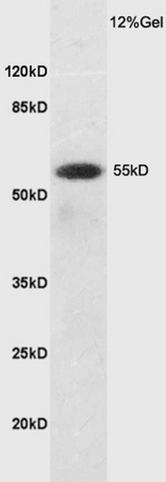 SLC7A5 Antibody in Western Blot (WB)