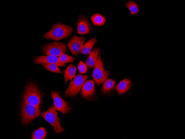 P21 Antibody in Immunocytochemistry (ICC/IF)