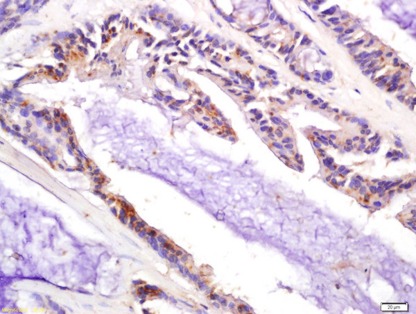 P21 Antibody in Immunohistochemistry (Paraffin) (IHC (P))