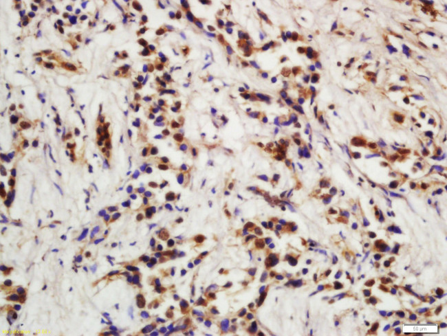 P21 Antibody in Immunohistochemistry (Paraffin) (IHC (P))