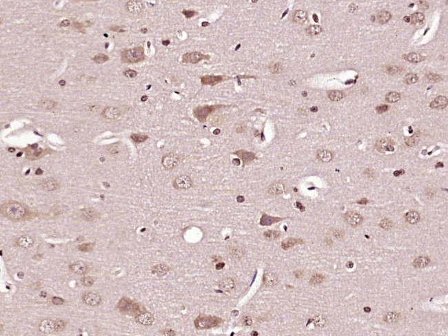 Caspase-6 subunit p11 Antibody in Immunohistochemistry (Paraffin) (IHC (P))