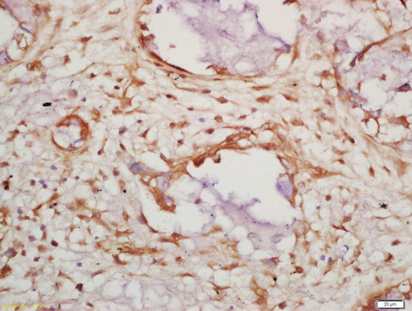 Caspase 14 Antibody in Immunohistochemistry (Paraffin) (IHC (P))