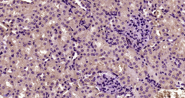 Desmoglein 2 Antibody in Immunohistochemistry (Paraffin) (IHC (P))