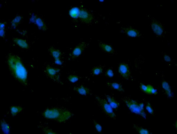 ALDH1 Antibody in Immunocytochemistry (ICC/IF)